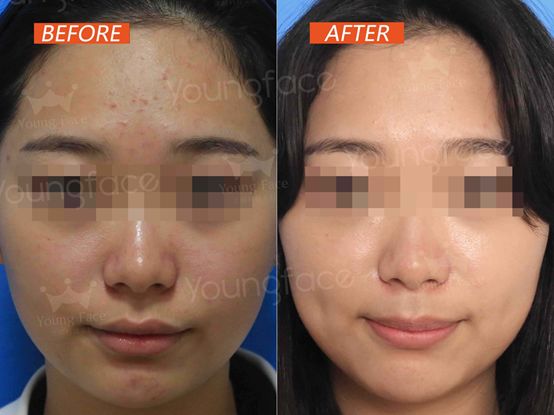 低至1元享星级护肤体验！小编亲测，十一月回血就靠它了