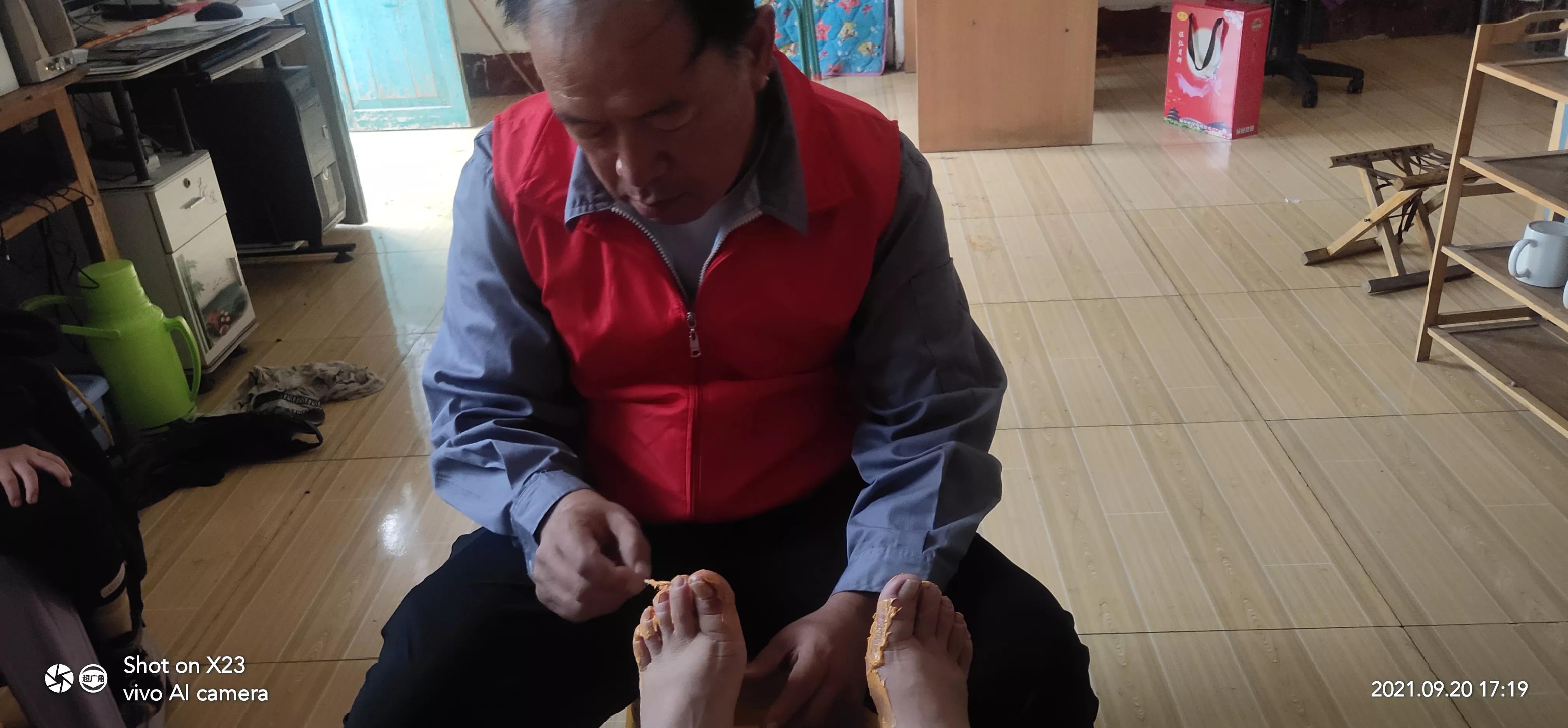 邹平皮肤病诊疗所,大名县农村偏方专治皮肤病