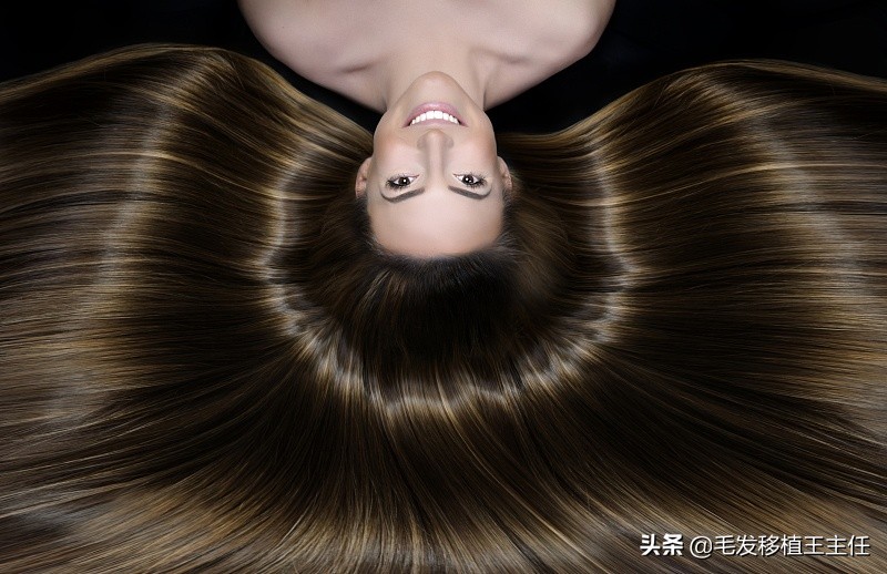 头发爱出油有头屑还痒,头痒头屑多还严重掉发怎么办