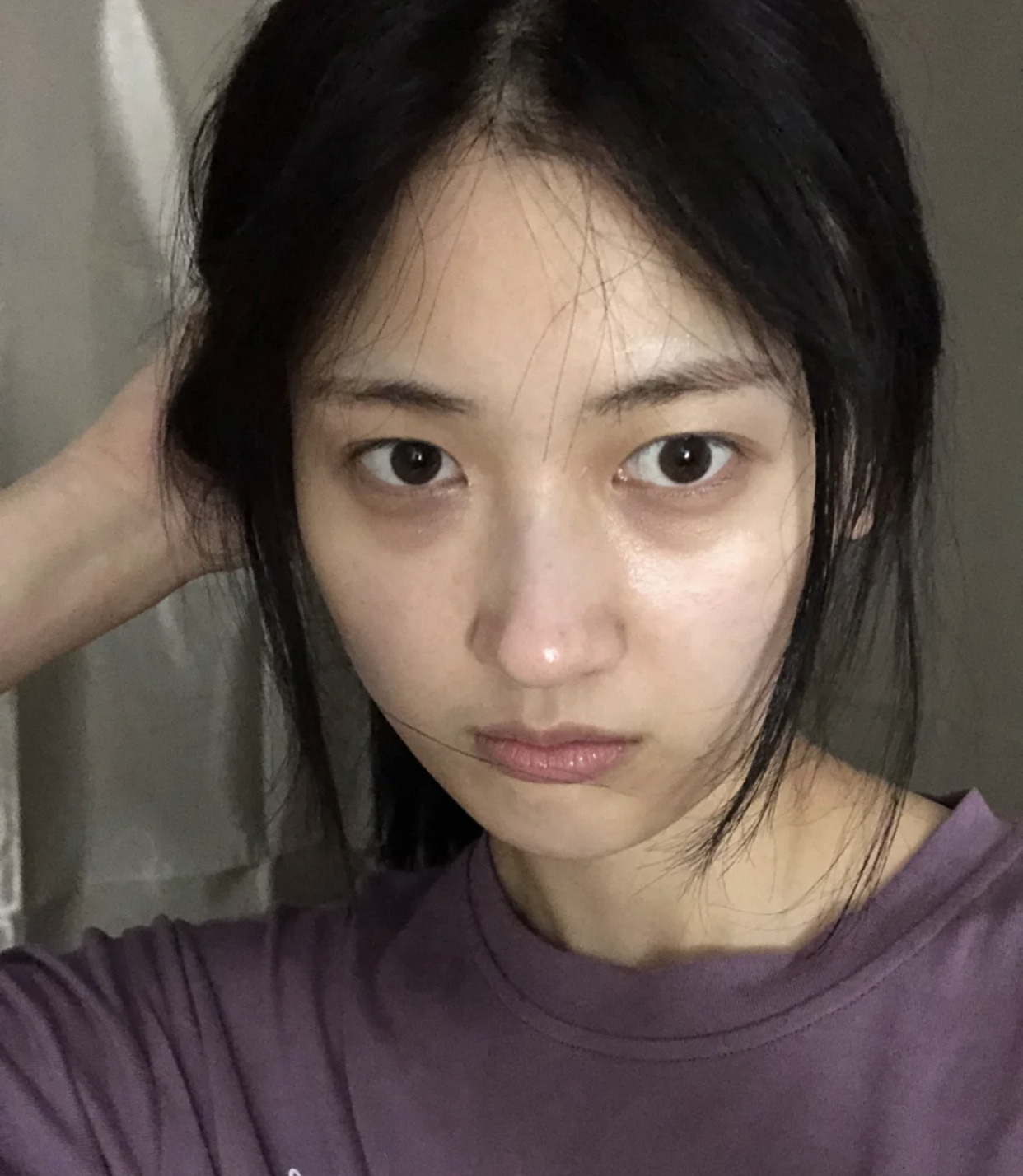 消除黑眼圈的方法有哪些,消除黑眼圈的最快方法