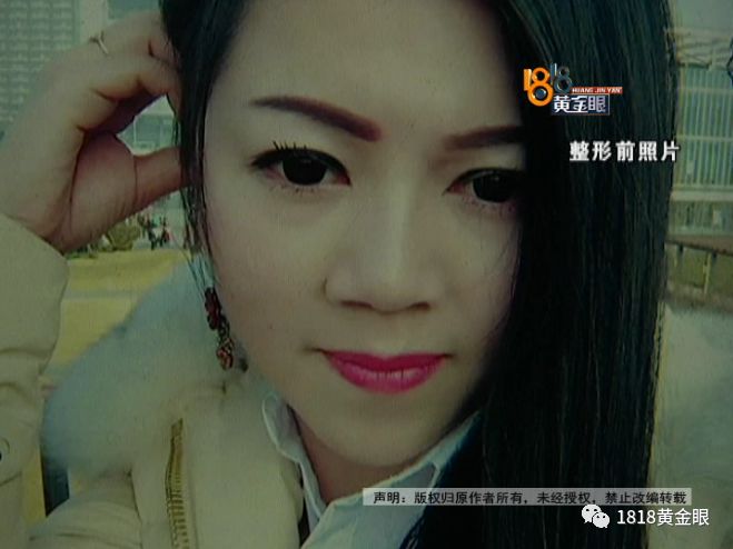 三年动刀三次,老公说她整得跟“猪”一样?