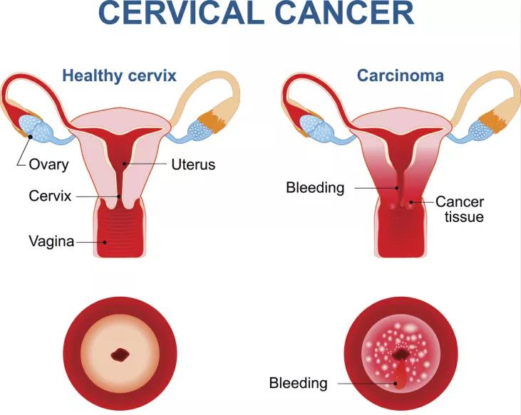 第一次去妇科检查需要注意什么,第一次产检妇科检查都有哪些项目