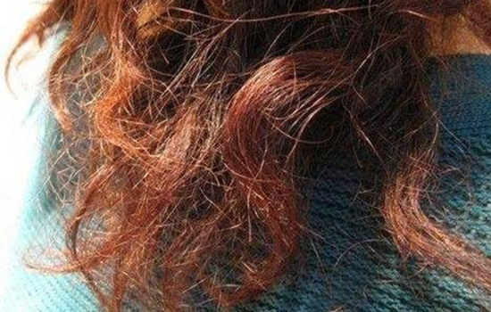 头发毛躁做软化好还是矫正好,男生头发干枯毛躁怎样软化