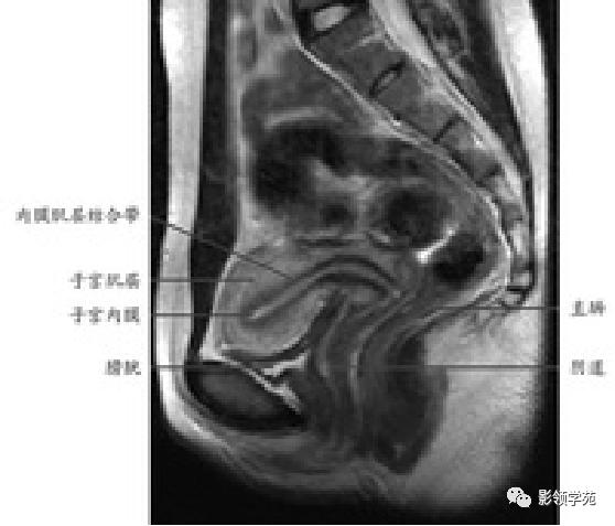 宫颈癌mri诊断,宫颈癌的mr扫描技术