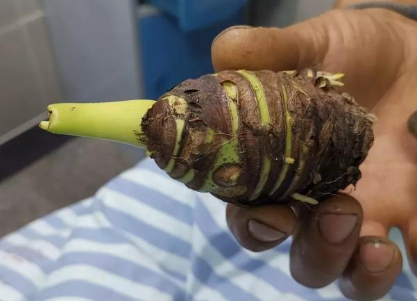 一女子吃有毒野果进医院,误食假芋头