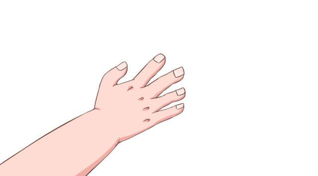 甲沟炎是因为不剪指甲嘛,甲沟炎自愈的十大方法儿童