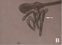 眼部螨虫,心灵窗户中不可忽视的隐秘角落,药师教您轻松预防治疗