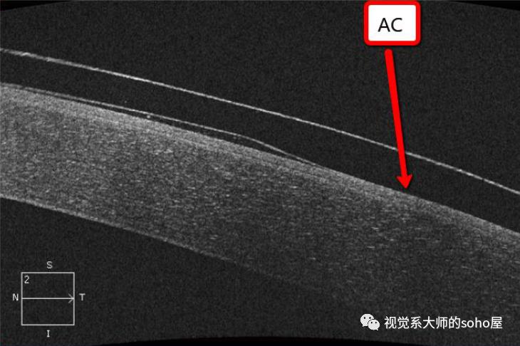 视光方面的知识,视光眼科科普