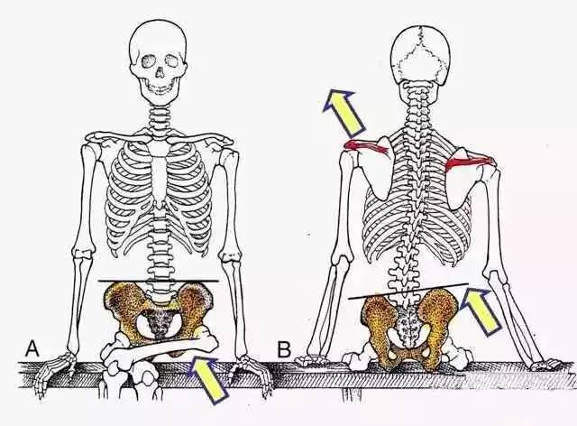 跷二郎腿骨盆倾斜可以正骨吗,跷二郎腿骨盆倾斜矫正
