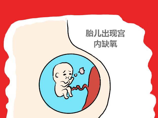 宝宝胎位不正怎么调整,胎位不正宝妈们是怎么调整过来的