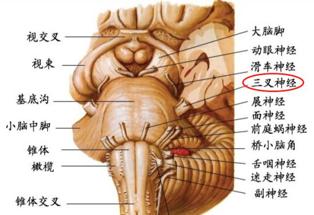 神经外科经典病例演讲,一分钟治愈三叉神经痛