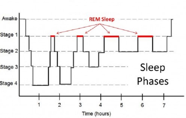 家里一间卧室睡觉总做梦,睡觉总做梦怎么回事第二天很累
