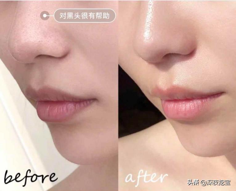 这些牌子护肤品别用小心烂脸,8款大牌护肤品不要买