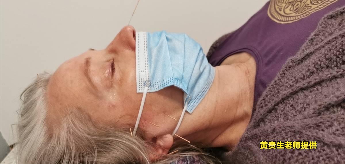 古派针灸，在欧洲治疗因痛经多次手术留下的后遗症