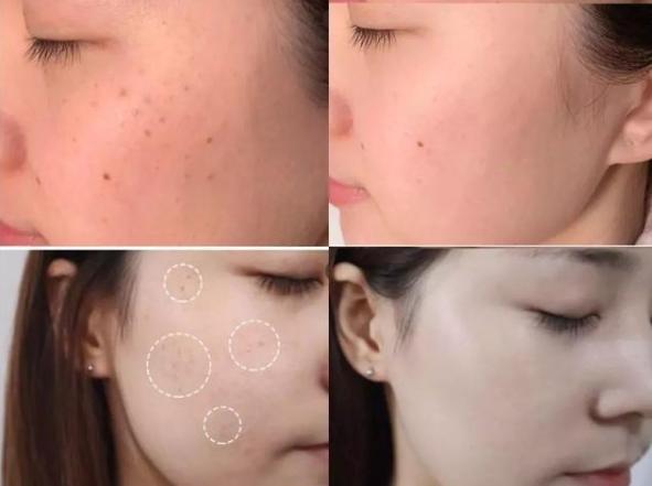 改善肌肤暗沉的便宜老国货,30岁以上混干皮肤色暗沉精华推荐