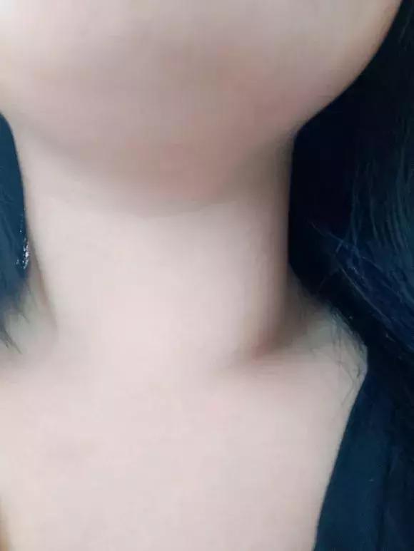 1分钟搞定结节告别多年烦恼,结节增大了怎么办