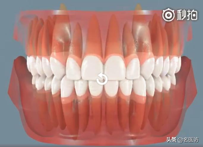 牙齿矫正注意事项和禁忌,牙齿矫正需要注意什么成人