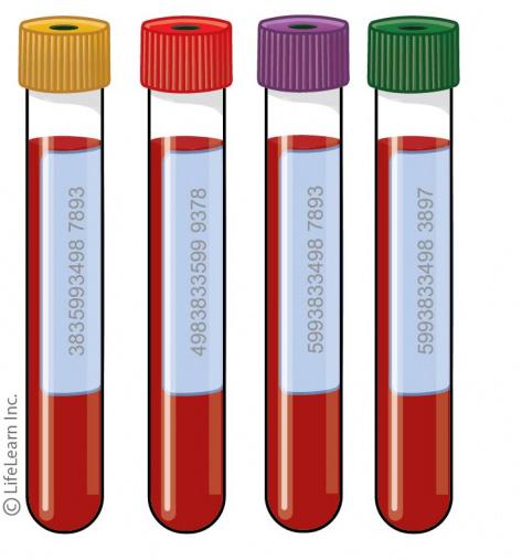 小狗得甲亢,小狗甲状腺机能低下