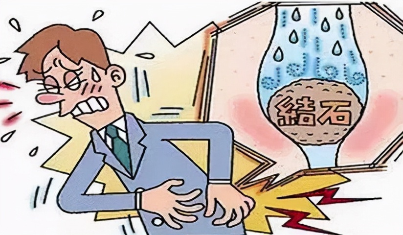 哪种结石可以做体外冲击波,科普体外冲击波是如何碎结石的