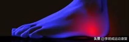 足跟痛的自我治疗方法,足跟痛艾灸的治疗方法