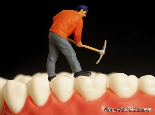 洗牙后觉得牙齿酸软是怎么回事,洗牙后牙齿一直酸软怎么改善