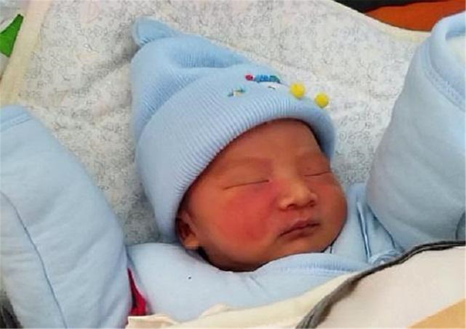 胎儿长胎记是怎么造成的,胎儿容易长胎记的原因是什么