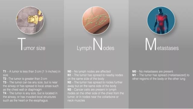 得癌症到底能活几年,得了癌症一般能活多久真实数据