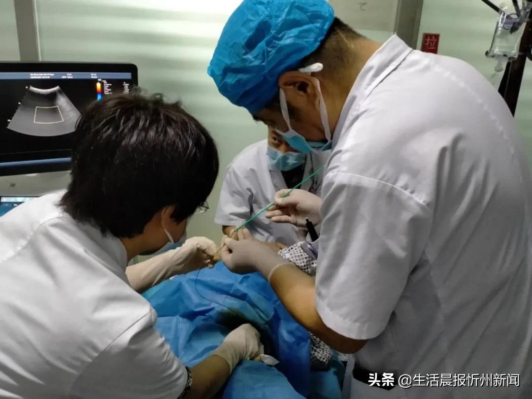 经皮肝穿刺胆道引流术县医院,经皮肝穿刺胆道引流术的并发症