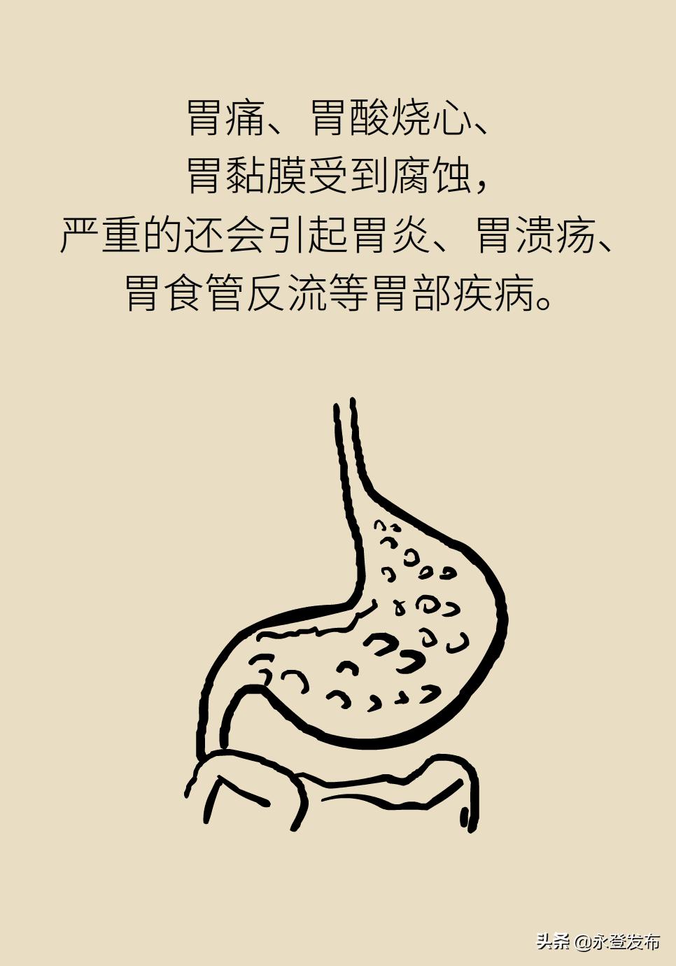 胃酸过多反酸烧心如何缓解,胃酸过多反胃烧心怎么办