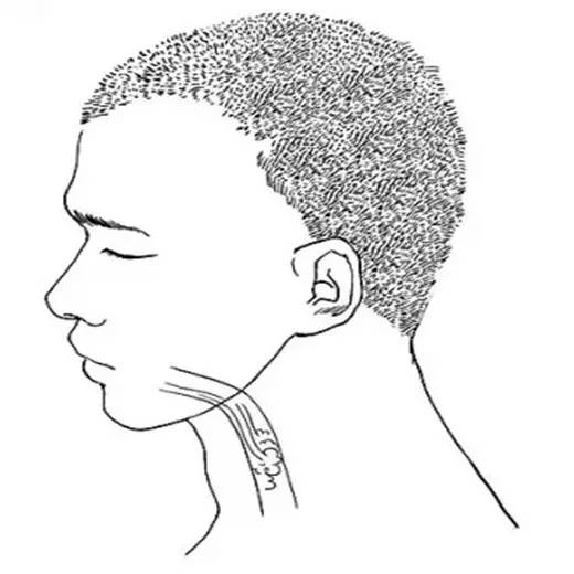 烂牙口臭的中医中药妙方,烂牙口臭有什么办法消除