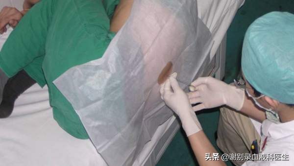 再障真的就那么难治吗,判断再障最简单的方法