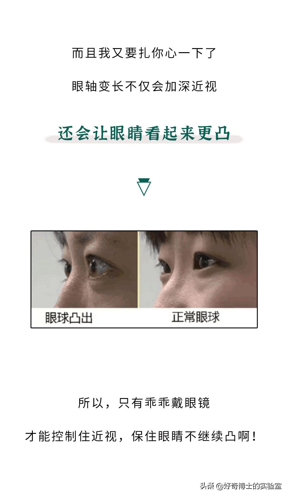 近视的人不戴眼镜会怎么样,近视的人不戴眼镜会恢复吗