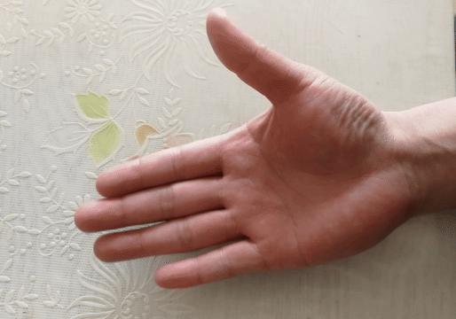 中年妇女手指疼痛僵硬是什么原因,老人手指腱鞘炎如何治疗