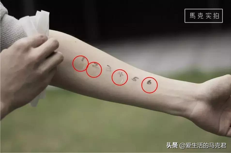 祛痘贴测评学生,各种痘痘贴测评