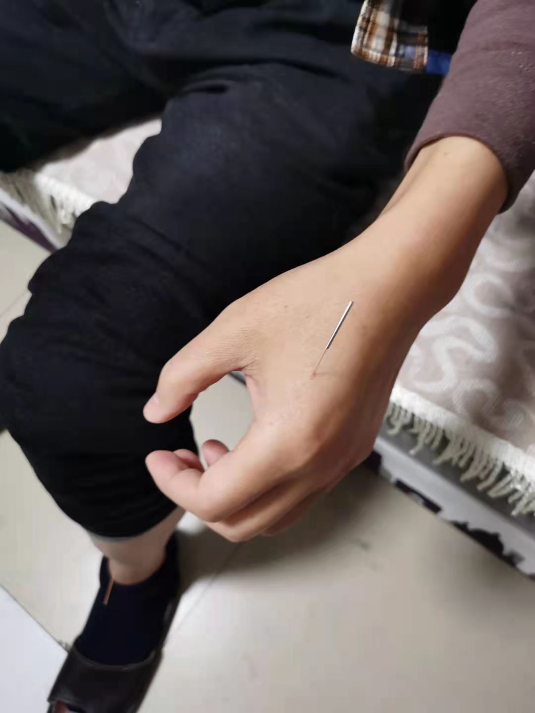 针灸治疗颈肩腰腿痛,针灸治疗颈肩腰腿痛的可行性分析