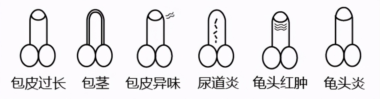 【呱呱教·59】小“鸡鸡”无小事，家长不可不知！