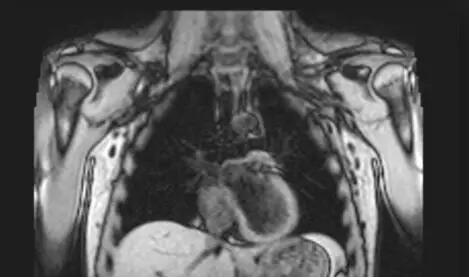 检查手段五花八门该如何抉择?医生教你选择肺癌诊断的最佳手段