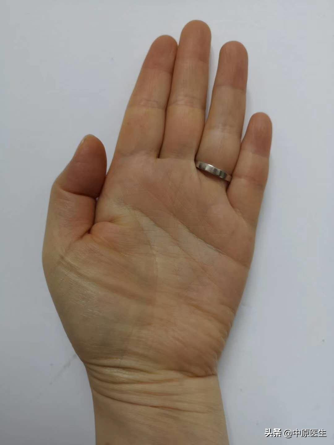 女人手黄脚底黄是什么原因,女性手黄是黄疸吗