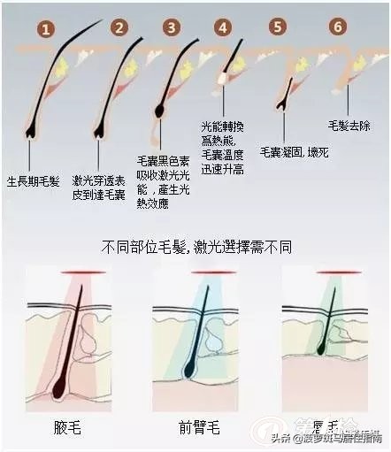 脱毛方法大盘点,脱毛攻略不要广告