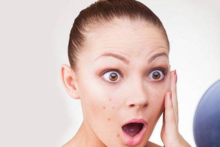 芦荟祛痘的效果真好吗,芦荟加蜂蜜祛痘