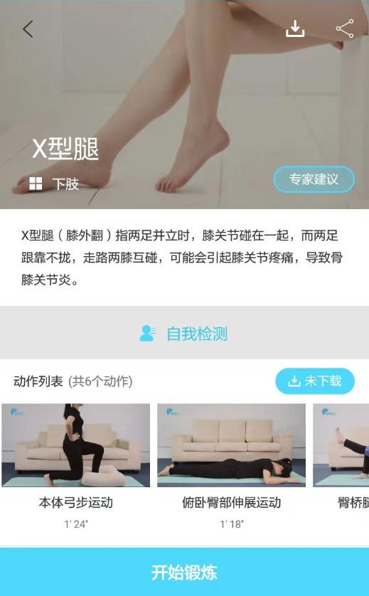 孩子x型腿应该怎么治疗,两岁孩子x型腿需要矫正吗