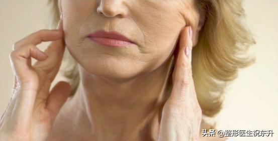 面部除皱大切口视频,除皱术的切口