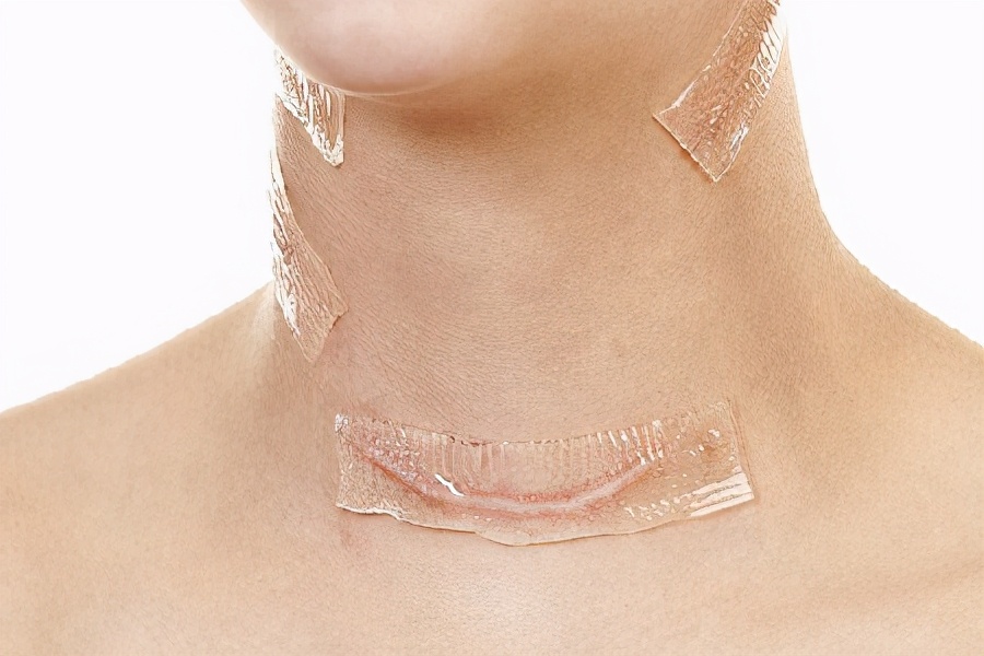 患了甲状腺癌怎么办？千万不要慌，一定注意以下几点