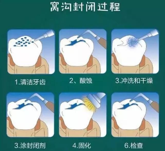 9岁的孩子蛀牙还没有换怎么办,9岁孩子蛀牙需要补牙吗