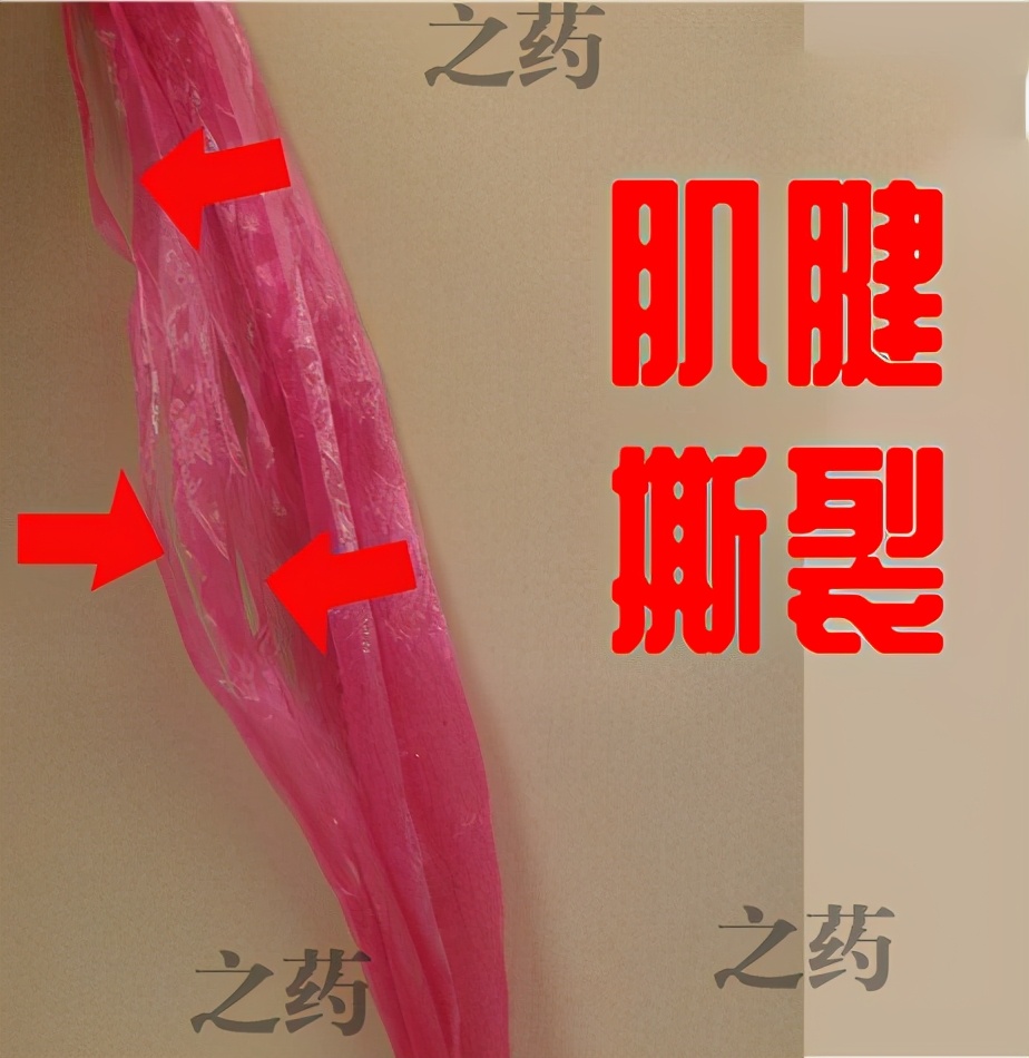 手抬不起来吃什么药,胳膊抬不起来警惕四种病