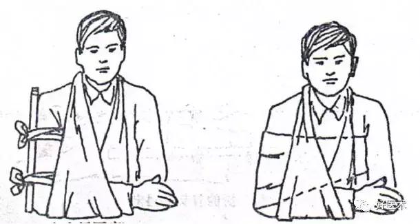 骨科急救处理流程图,骨科急救原则及注意事项