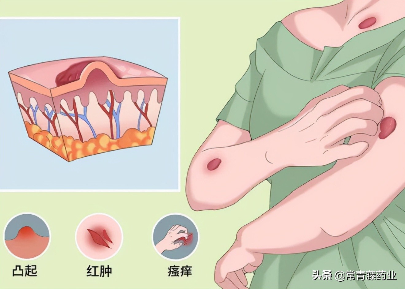 爱美之心，人皆有之，瘢痕的这些事是你想要知道的吗？