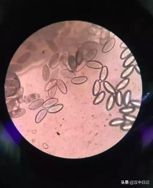 6岁宝宝怎么能判断身体有没有虫,孩子身体有虫子怎么才能查出来