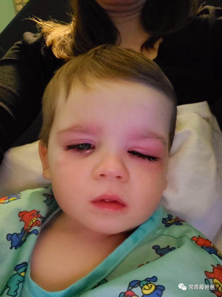 蠢萌蠢萌的洗澡鸭，差点让我儿子失去了一只眼