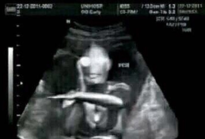 街头采访打电话说自己怀孕了,街头采访女朋友意外怀孕